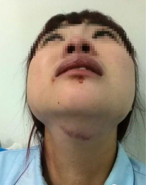 上海第五人民医院怎么样?护士待遇怎么样啊?