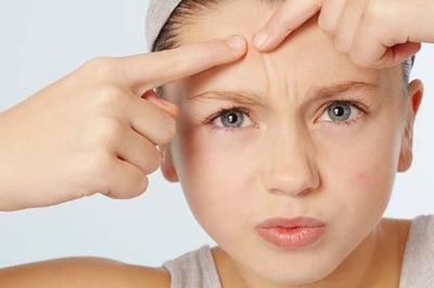 痤疮长在哪最担心?中医透视痤疮辨疾病(1)