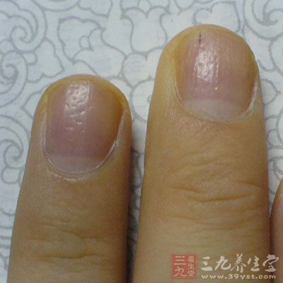 气血不足自我检测大法 赶紧测一下(3)