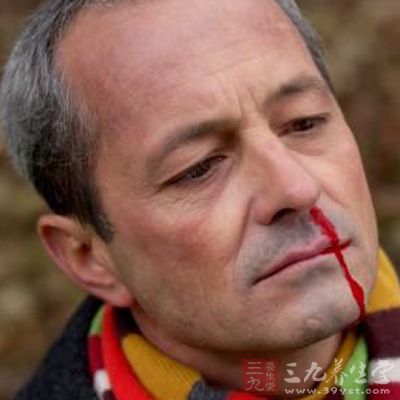 流鼻血是什么原因?夏天流鼻血怎么办(2)