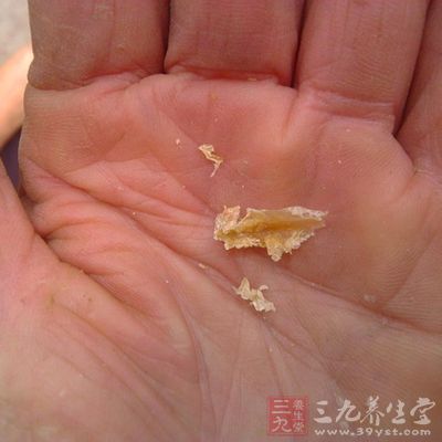 耳朵出现这物竟会威胁生命(6)