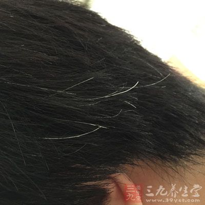 小小一处擦伤竟然险些要了命(4)_要闻 _光明网