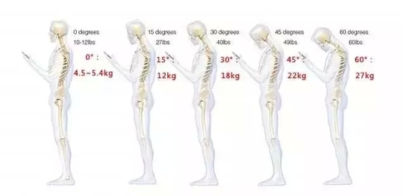 低头弯腰颈椎多受伤 5招让你远离颈椎病(1)