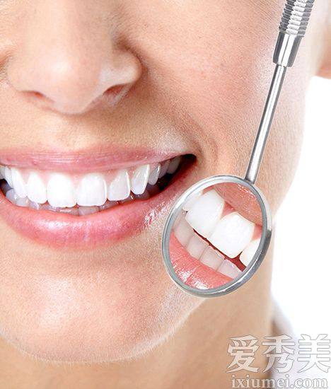 牙齿美白最好的方法 牙贴激光美牙有效吗﹖(2