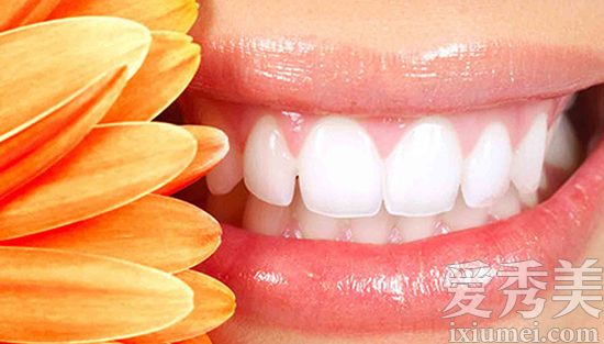 牙齿美白最好的方法 牙贴激光美牙有效吗?(4)