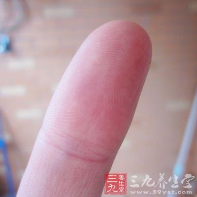 手指上簸箕暗示了你什么(7)