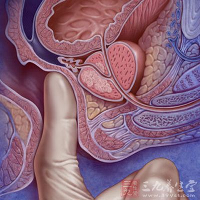 这里堵塞竟成男人心腹大患 肛指检查﹐是诊断