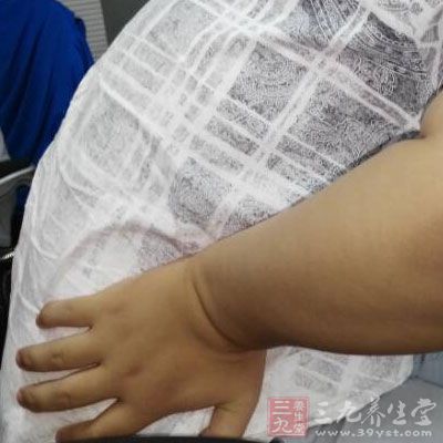 吃什么东西补肾补精 c03fd5535e9c17eed58b3f.jpg