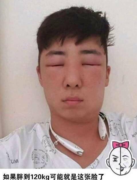 男子染头发后头肿脸涨 自拍记录全过程(3)