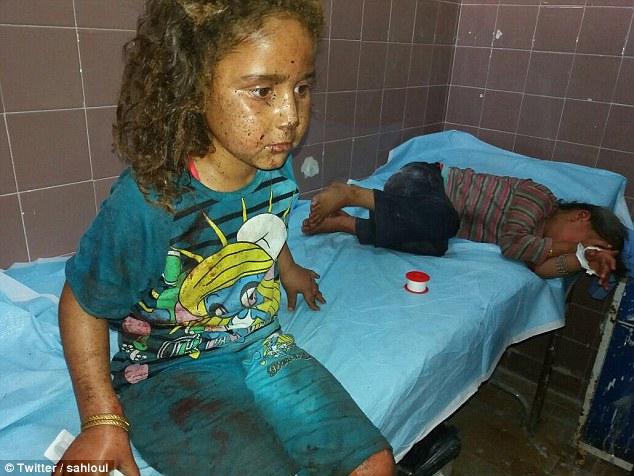 叙利亚遭汽油弹轰炸的孩子 药物缺少用泥浆缓