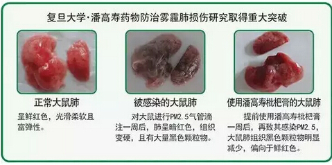 【健康百科】春季“咳、咳、咳”到底为哪般