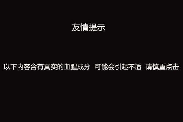 苏联解禁照:珍宝岛战役中<em>死亡</em>的苏军[组图](1)_