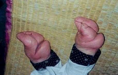 揭秘三寸金莲背后秘密(4)_历史要闻 _光明网