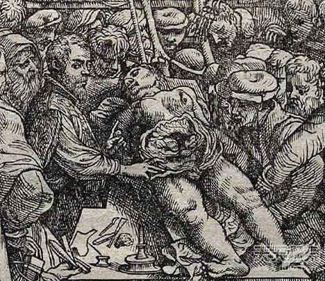 史上十大惊悚人体解剖:人皮制成书籍(8)