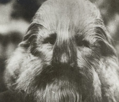 纽约19世纪怪异畸形奇人照:长四条腿女孩狗脸