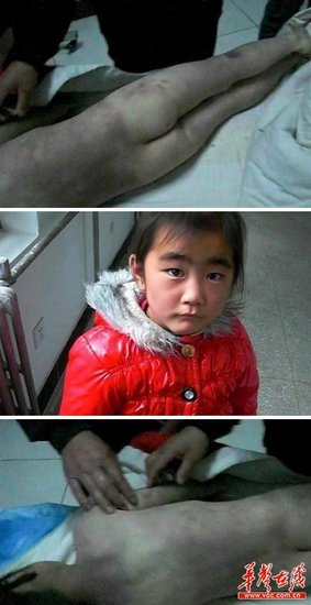 7岁<em>女孩</em>疑被继母<em>虐待</em>致死 涉案人被刑拘(图) _