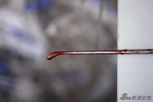做无痛人流手术前需要做什么 002564a5eab8125f4e424c.jpg