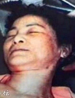 当得知邓丽君发病紧急就医的事情后