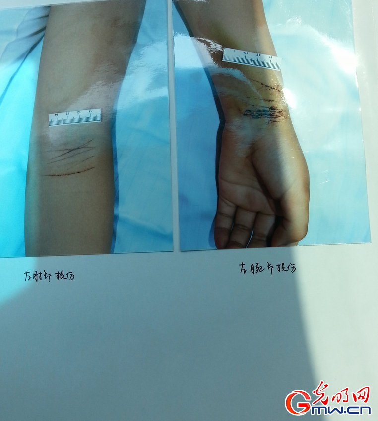 郑州回应<em>少女</em>戒<em>网瘾</em>死:学校办学资质被撤销(