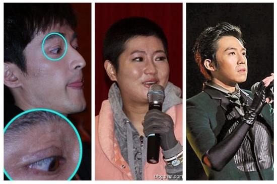 盘点意外惨 毁容 明星: 俞灏明 烧伤胡歌车祸(1)_法