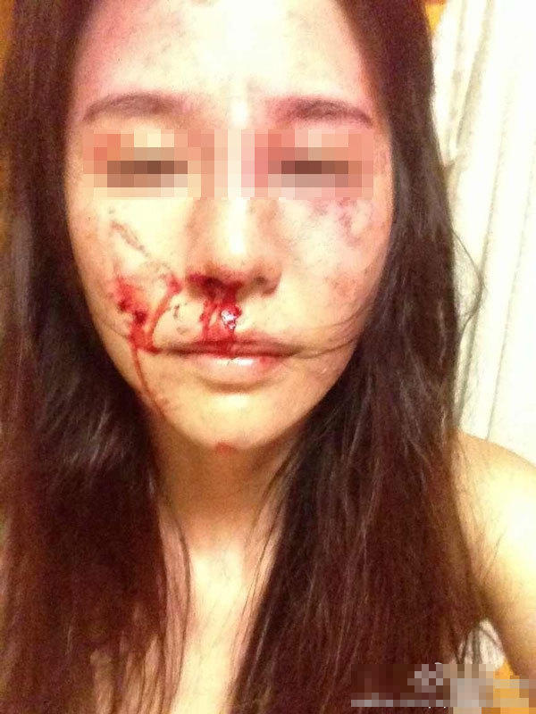 曝舞蹈演员拒弃抚养权遭家暴(2)