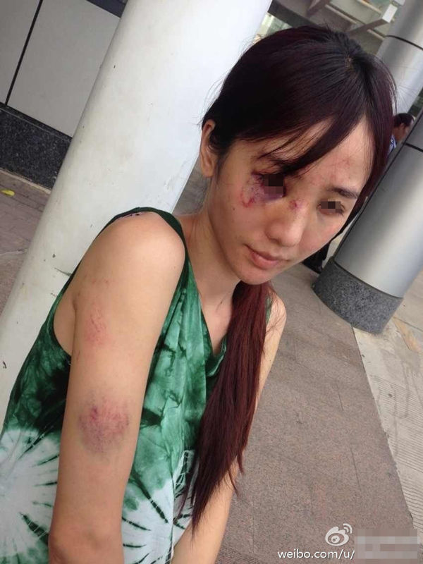 <em>美女</em>演员被家暴不堪入目 基德曾妻子<em>虐待</em>(2)_法