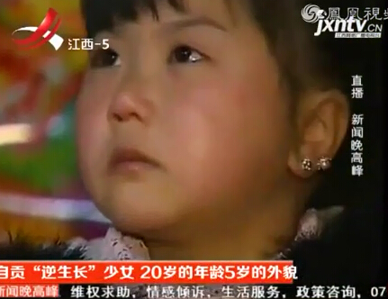 <em>花季少女</em>逆生长 20岁的<em>年龄</em>仅有5岁外貌 _法