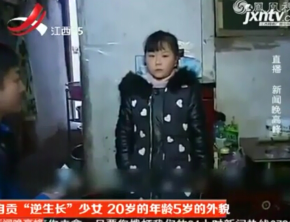 <em>花季少女</em>逆生长 20岁的<em>年龄</em>仅有5岁外貌 _法