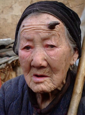 什么是e生保 六十岁老人买e生保