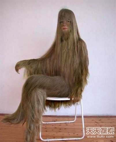 9岁女童全身长毛 盘点﹕全球的怪异病人﹗(11