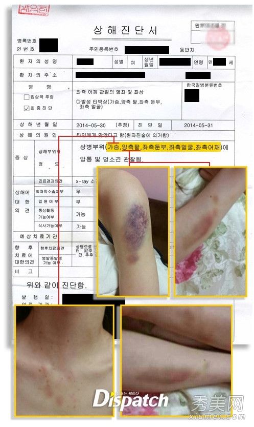 韩星遭老公家暴32年 女星被打的鼻青脸肿求助谁？