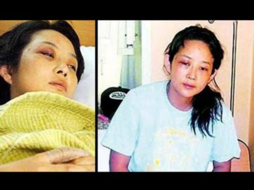韩星遭老公家暴32年 女星被打的鼻青脸肿求助谁？