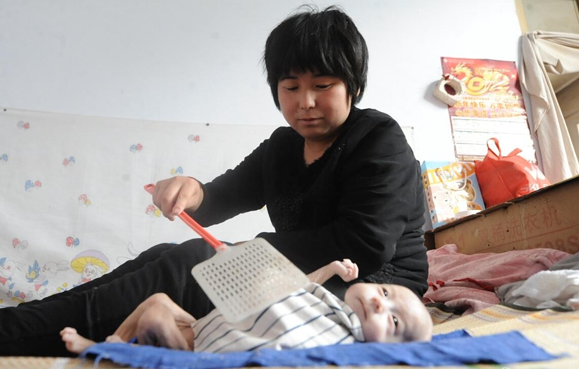 无肛男婴酷似外星人 出生80天仅4.8斤(组图)