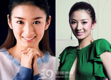 3.15打假十大体娱圈女星整容前后对比大揭秘(5)_