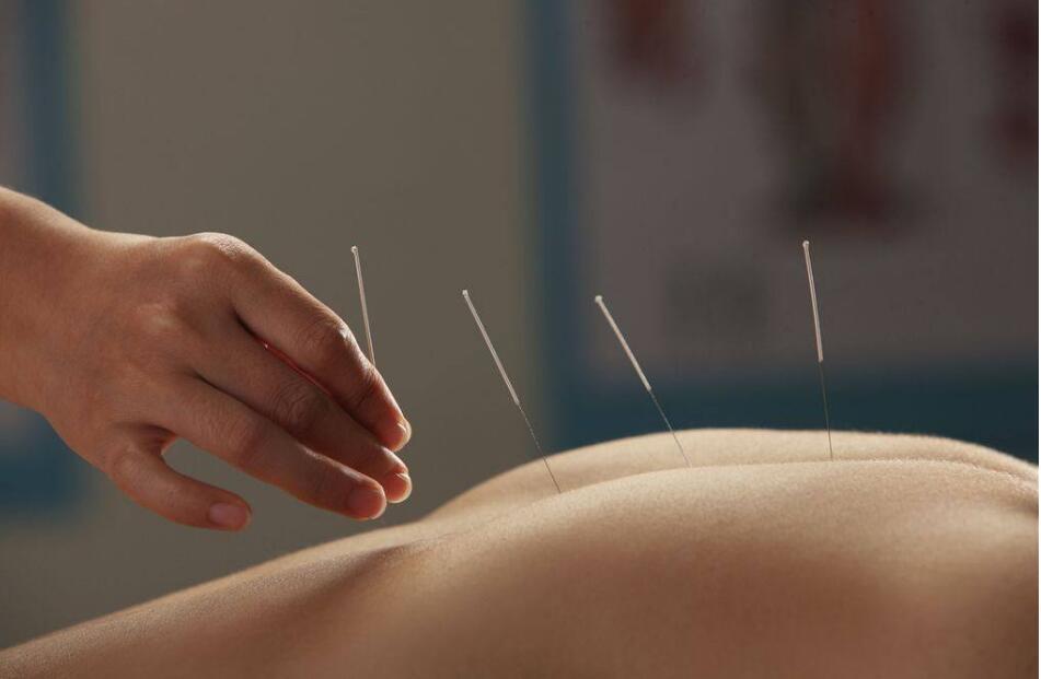Traditional Chinese medicine acupuncture attracts fans abroad