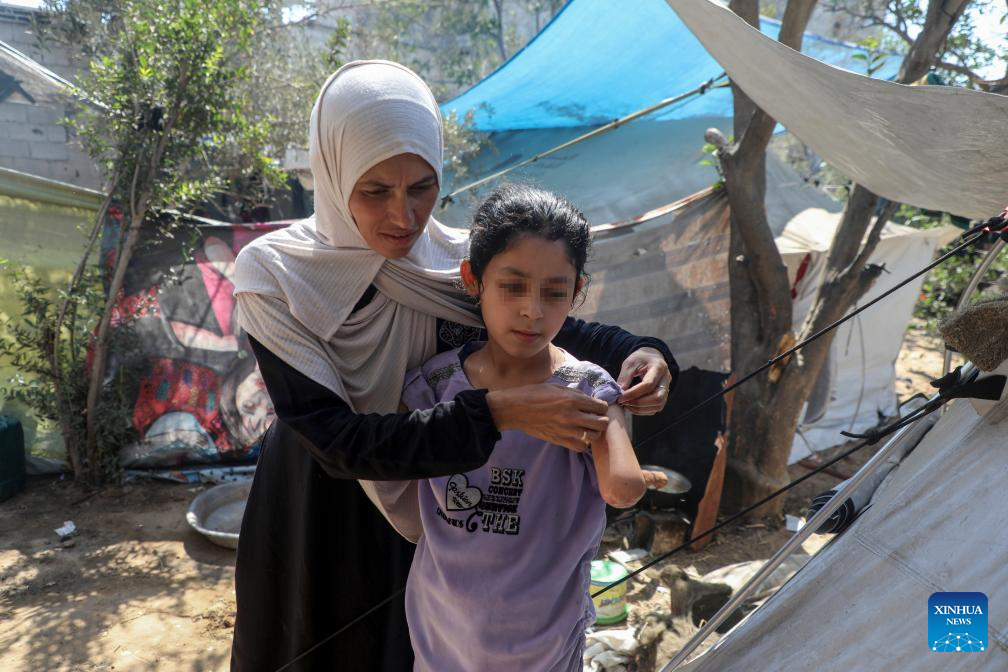 Gaza's young amputees struggle to heal amid war, medical collapse